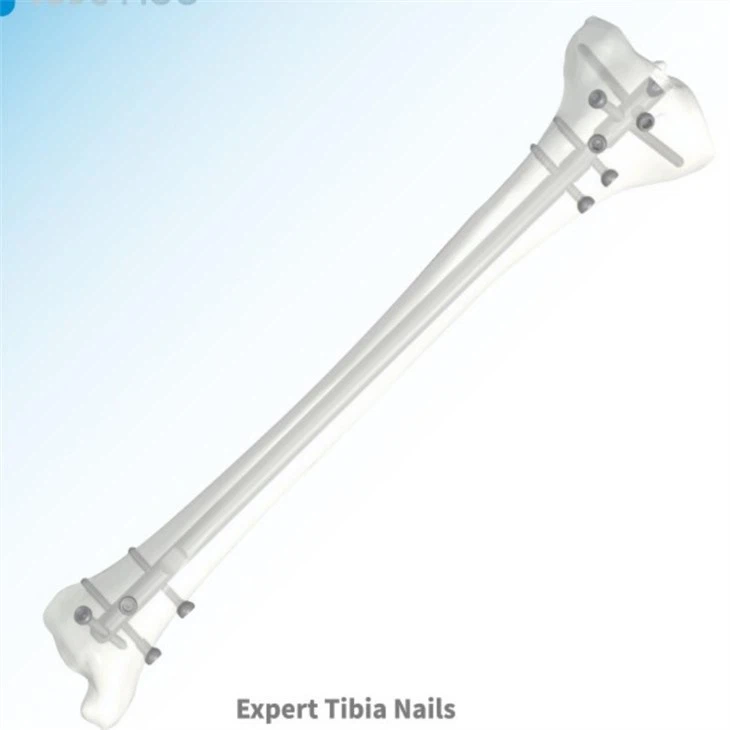 reamed intramedullary nail