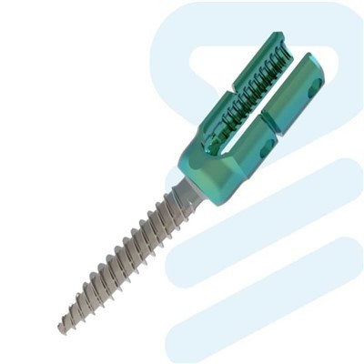 5.5 6.0 mm implantes internos de fixação da coluna vertebral