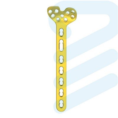 Placa de ângulo variável de raio distal