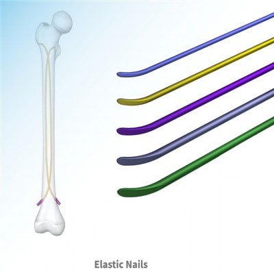 Unha elástica intramedular