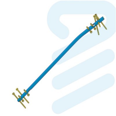 Tíbia de unhas interligadas intramedulares