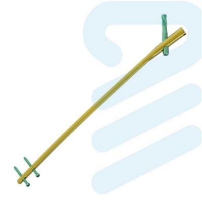Unha interligada de reconstrução femoral de titânio