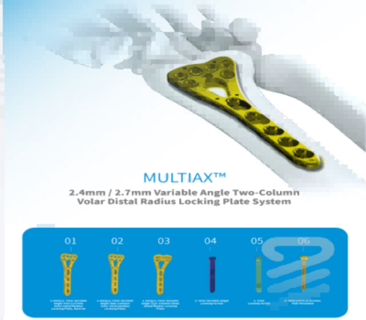 Placa de travamento do raio distal de ângulo variável